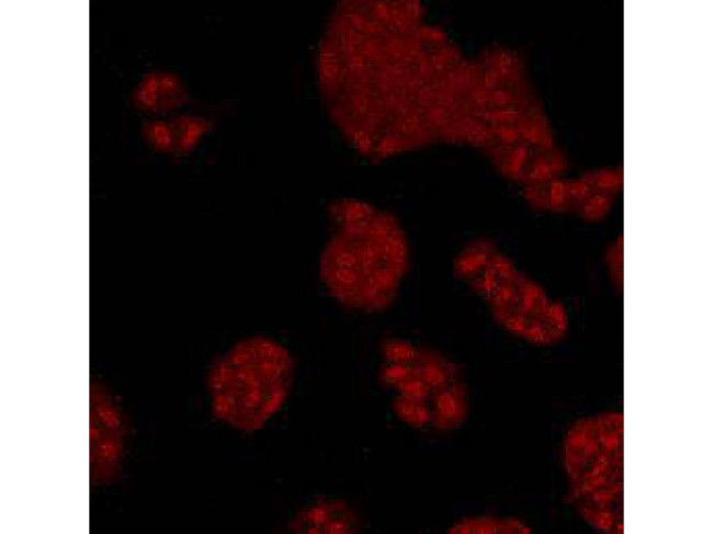 MAPK14 Antibody in Immunocytochemistry (ICC/IF)