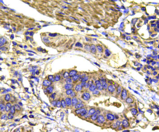 MAPK14 Antibody in Immunohistochemistry (Paraffin) (IHC (P))