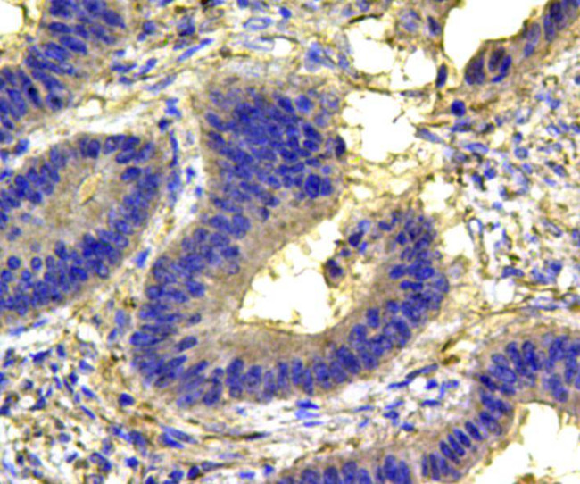 MAPK14 Antibody in Immunohistochemistry (Paraffin) (IHC (P))