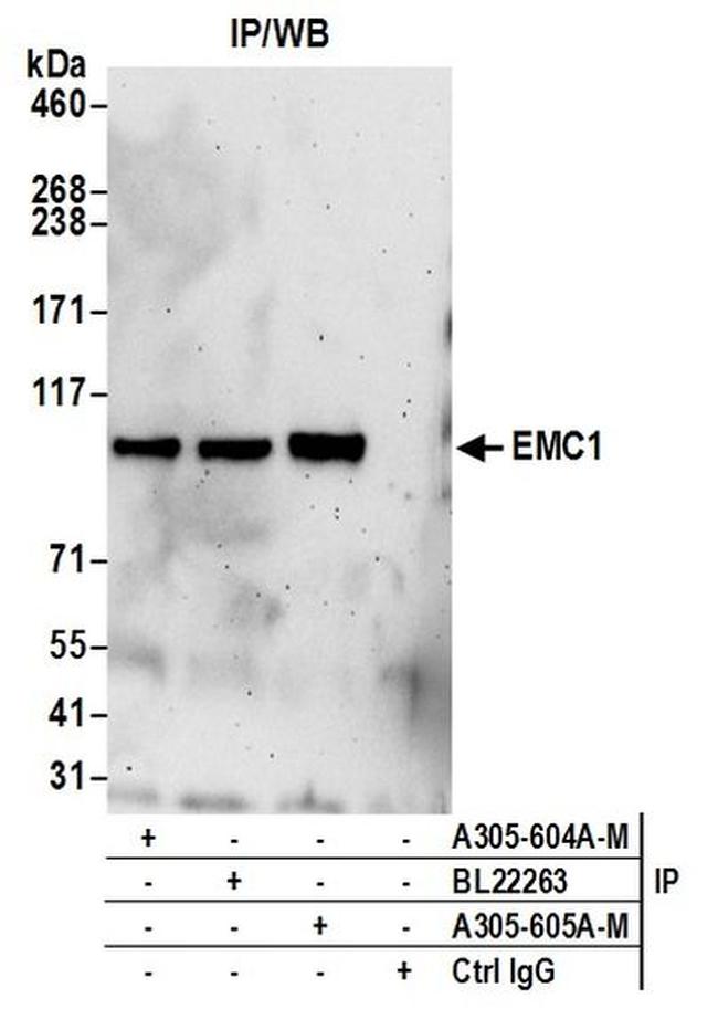 EMC1 Antibody in Western Blot (WB)