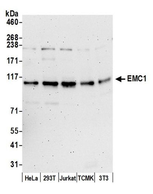 EMC1 Antibody in Western Blot (WB)