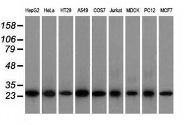 EMG1 Antibody in Western Blot (WB)