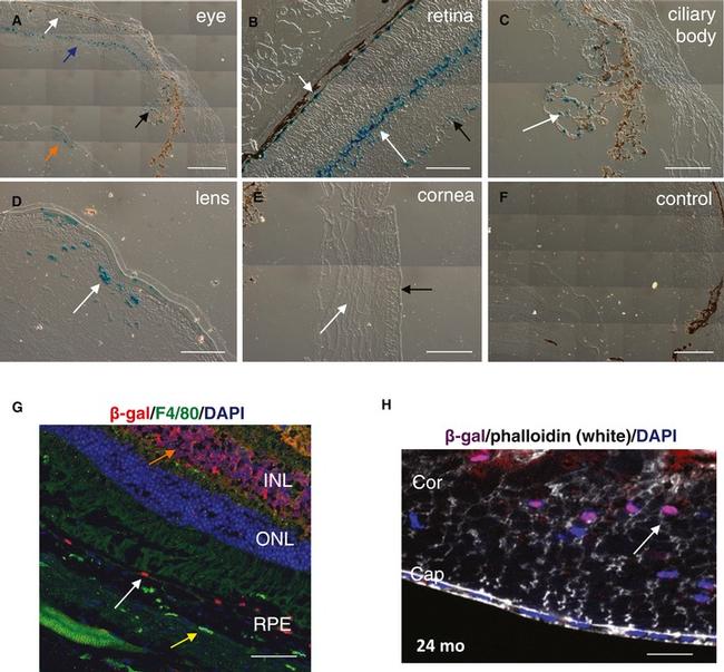 beta Galactosidase Antibody in Immunohistochemistry (IHC)