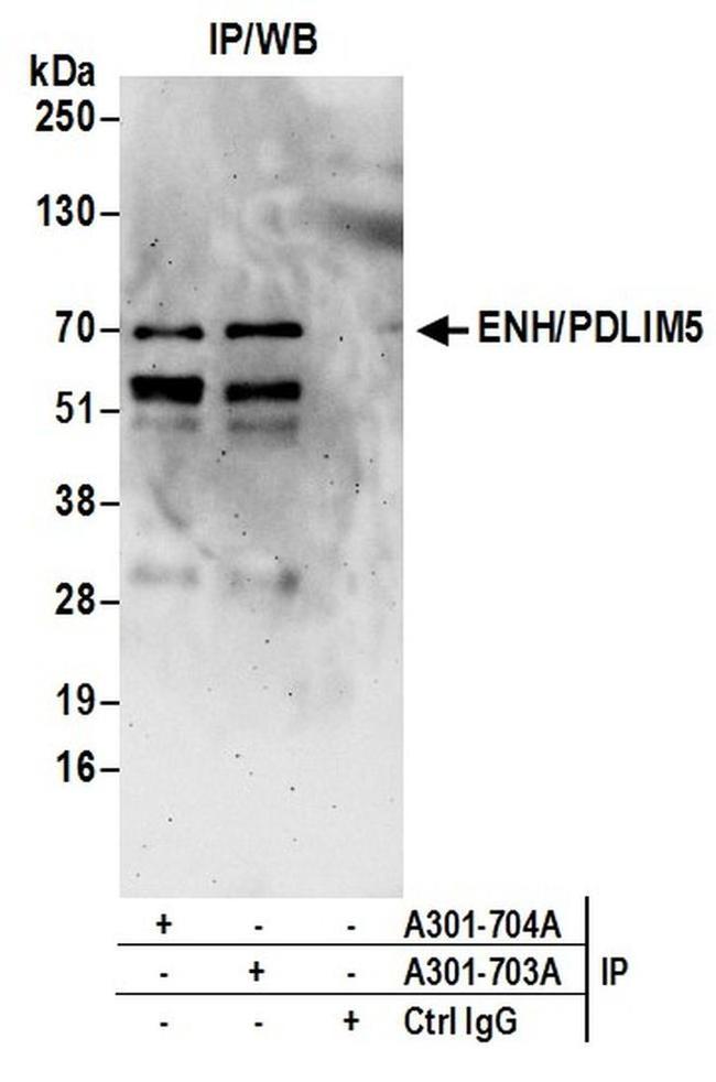 ENH/PDLIM5 Antibody in Western Blot (WB)