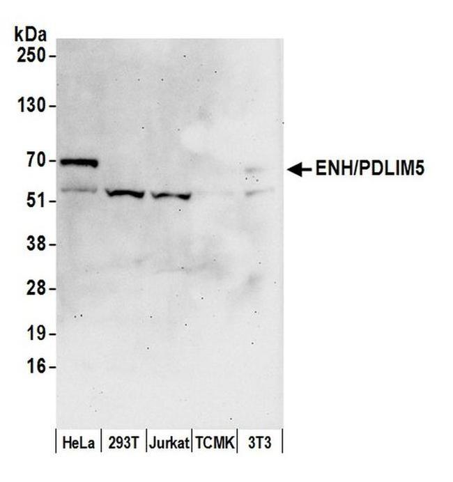 ENH/PDLIM5 Antibody in Western Blot (WB)