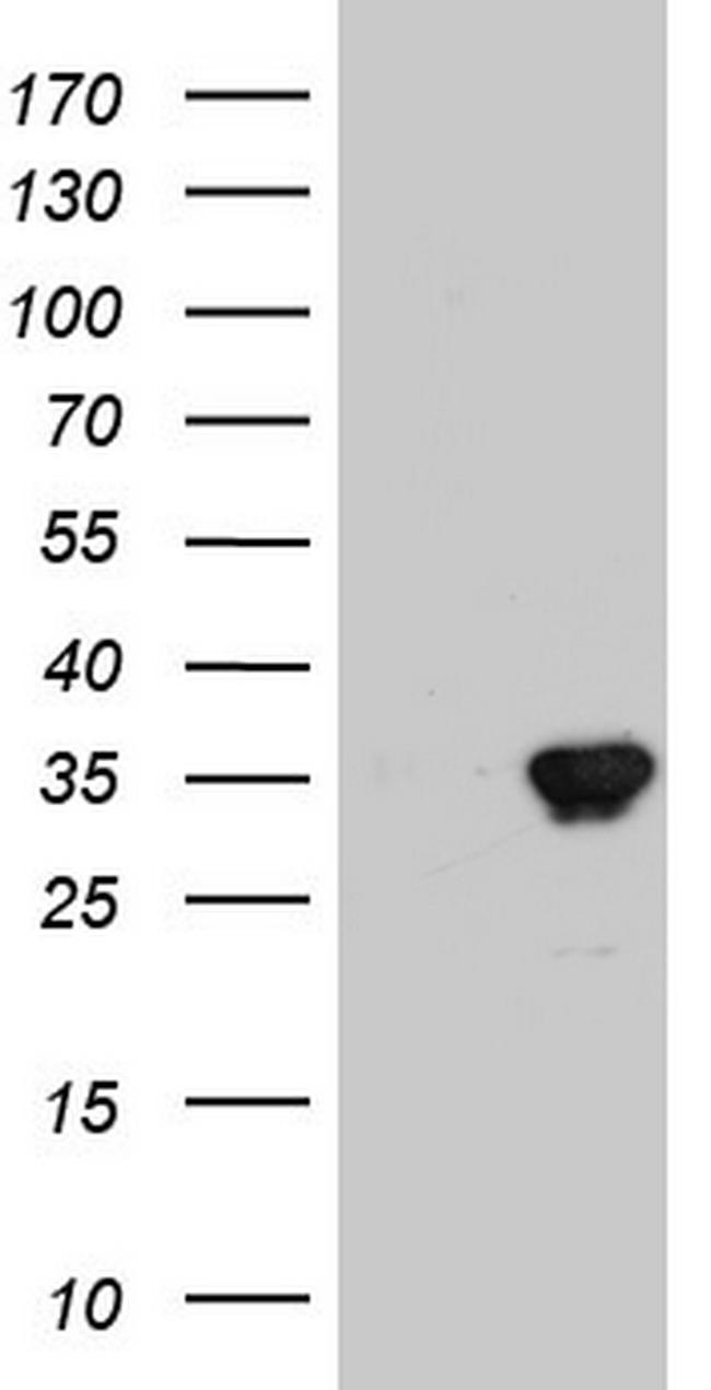 ENKUR Antibody in Western Blot (WB)