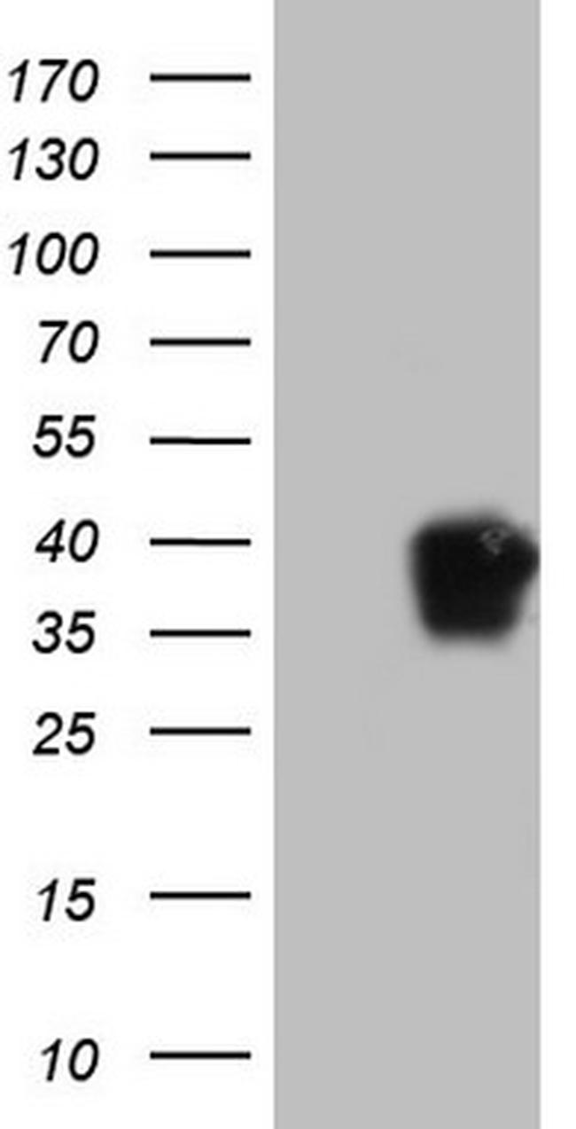 ENKUR Antibody in Western Blot (WB)