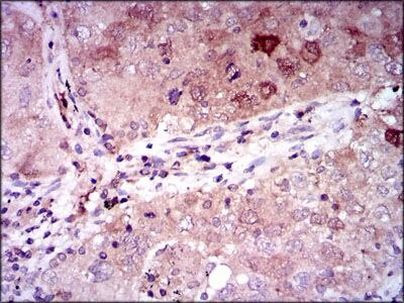 NSE Antibody in Immunohistochemistry (Paraffin) (IHC (P))