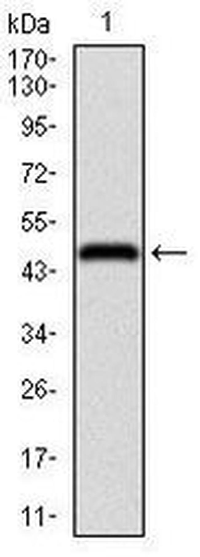 NSE Antibody in Western Blot (WB)