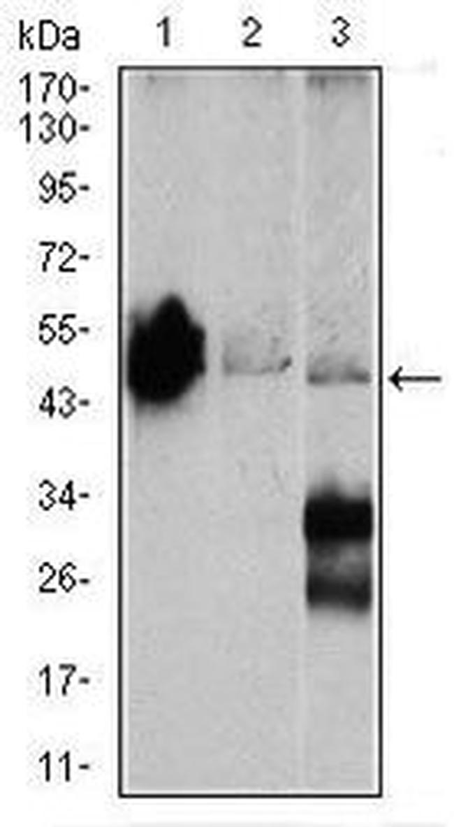 NSE Antibody in Western Blot (WB)