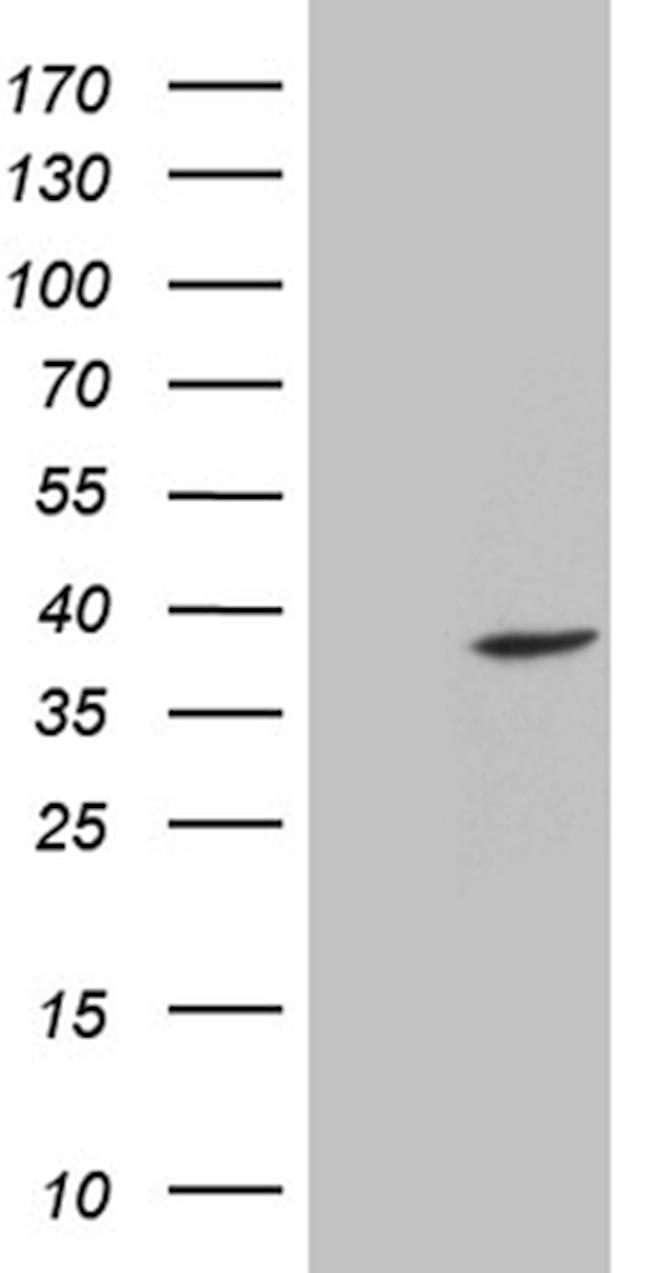 ENOPH1 Antibody in Western Blot (WB)