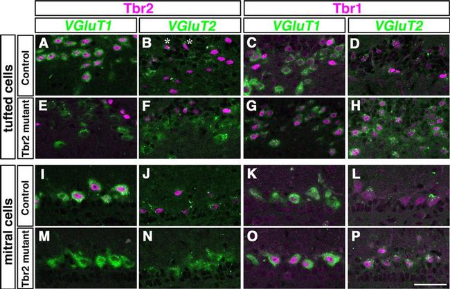 EOMES Antibody in Immunohistochemistry (IHC)