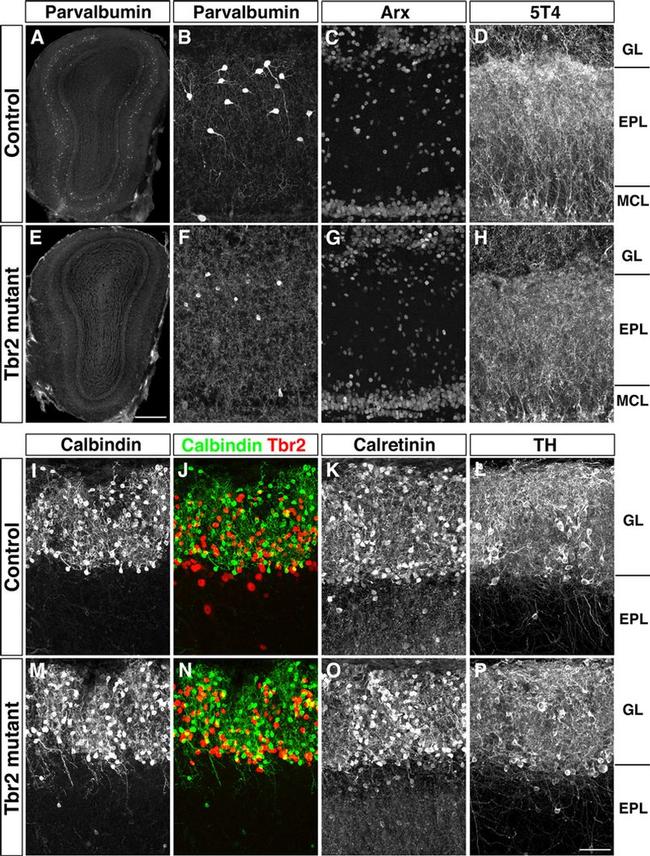 EOMES Antibody in Immunohistochemistry (IHC)