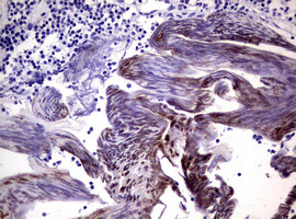 EPAS1 Antibody in Immunohistochemistry (Paraffin) (IHC (P))