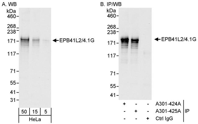 EPB41L2/4.1G Antibody in Western Blot (WB)