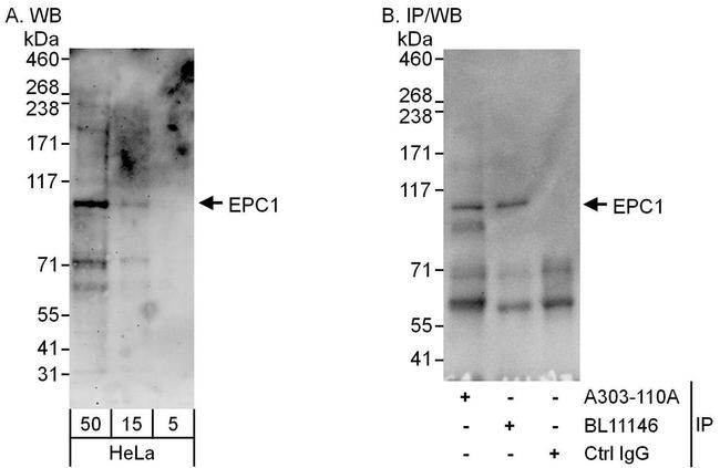 EPC1 Antibody in Western Blot (WB)