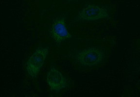 EPCAM Antibody in Immunocytochemistry (ICC/IF)