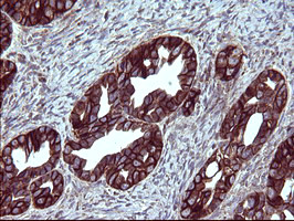 EPCAM Antibody in Immunohistochemistry (Paraffin) (IHC (P))