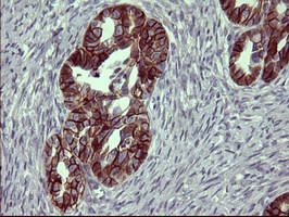 EPCAM Antibody in Immunohistochemistry (Paraffin) (IHC (P))