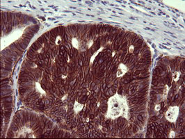 EPCAM Antibody in Immunohistochemistry (Paraffin) (IHC (P))