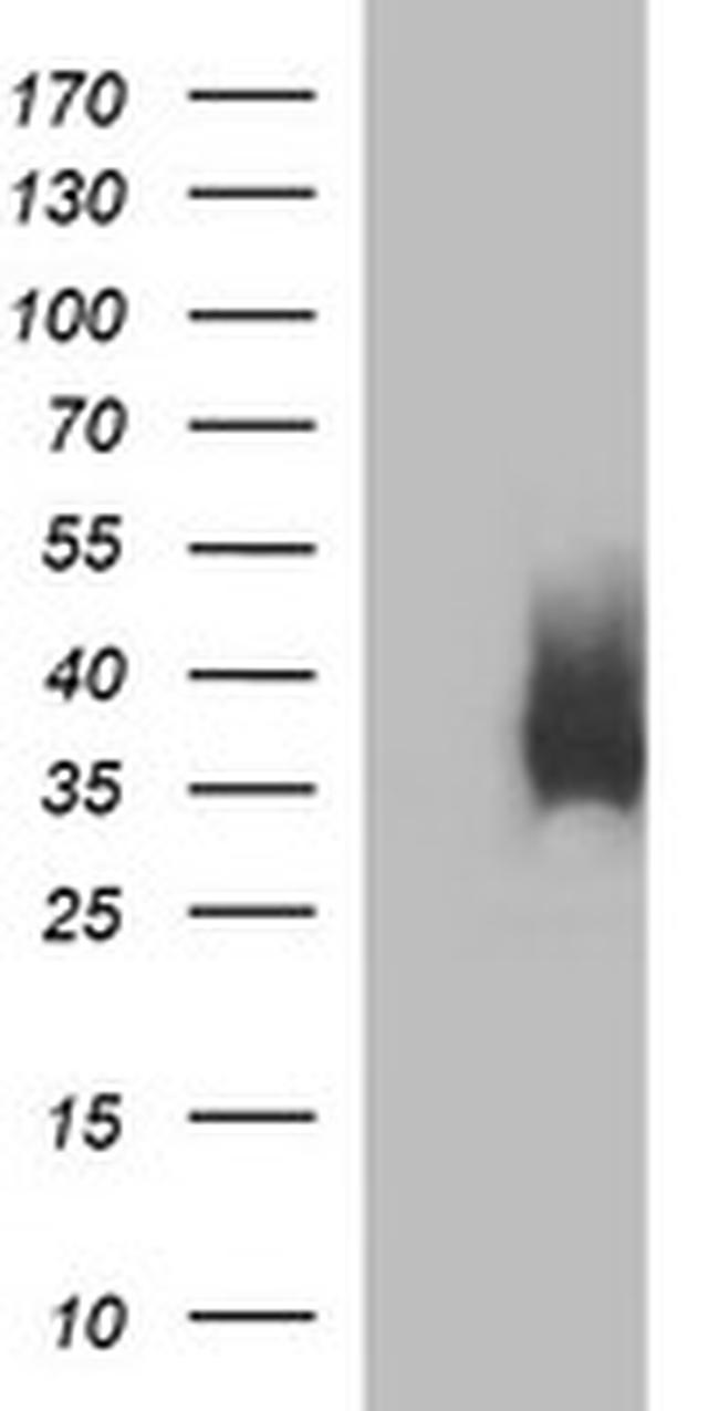 EPCAM Antibody in Western Blot (WB)