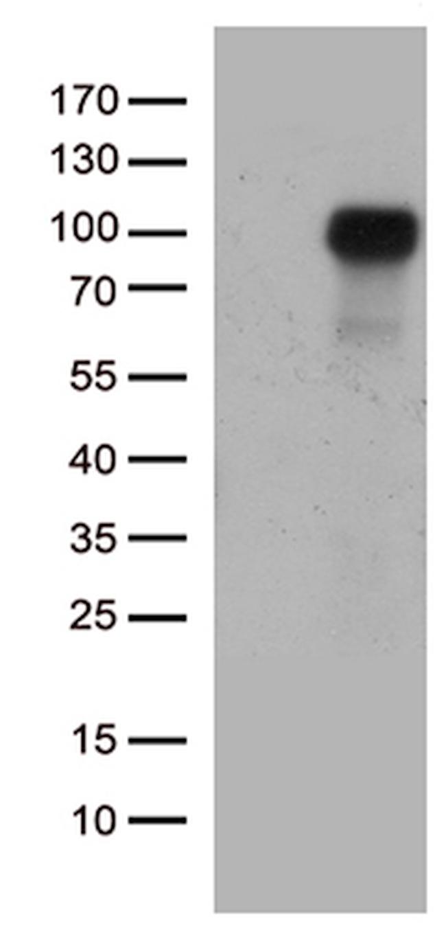 EPHA1 Antibody in Western Blot (WB)