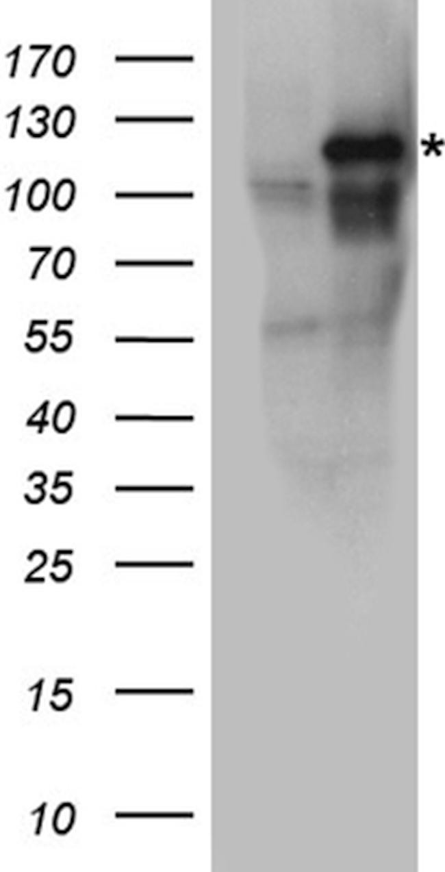 EPHA3 Antibody in Western Blot (WB)