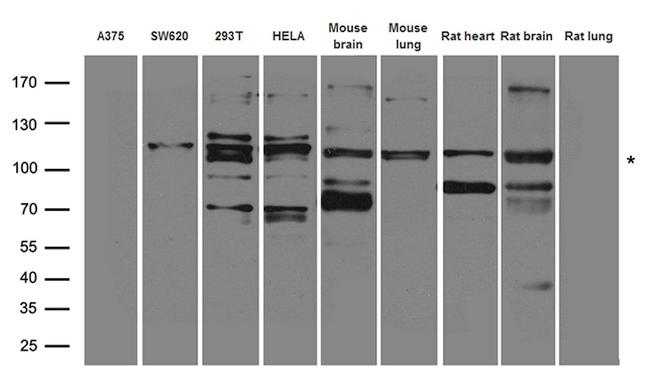 EPHA3 Antibody in Western Blot (WB)