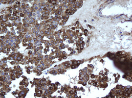 EPHX1 Antibody in Immunohistochemistry (Paraffin) (IHC (P))