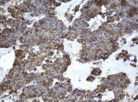 EPHX1 Antibody in Immunohistochemistry (Paraffin) (IHC (P))