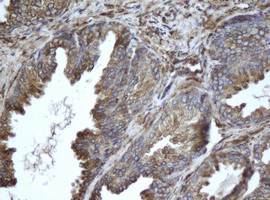 EPHX1 Antibody in Immunohistochemistry (Paraffin) (IHC (P))