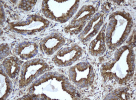 EPHX1 Antibody in Immunohistochemistry (Paraffin) (IHC (P))