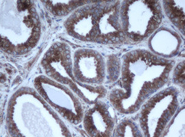 EPHX1 Antibody in Immunohistochemistry (Paraffin) (IHC (P))