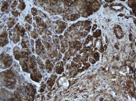 EPHX1 Antibody in Immunohistochemistry (Paraffin) (IHC (P))