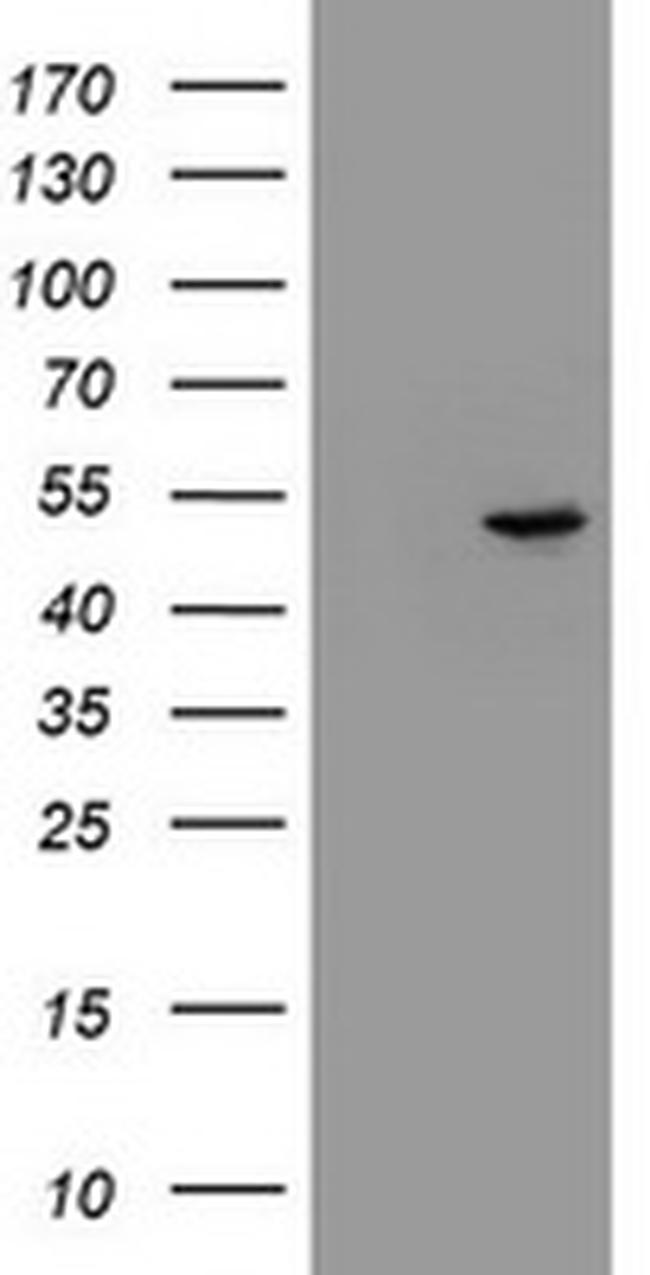 EPHX1 Antibody in Western Blot (WB)