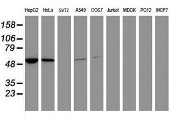 EPHX1 Antibody in Western Blot (WB)