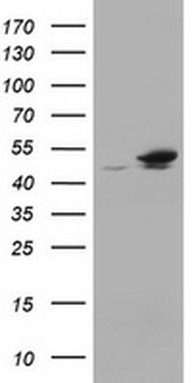 EPHX1 Antibody in Western Blot (WB)