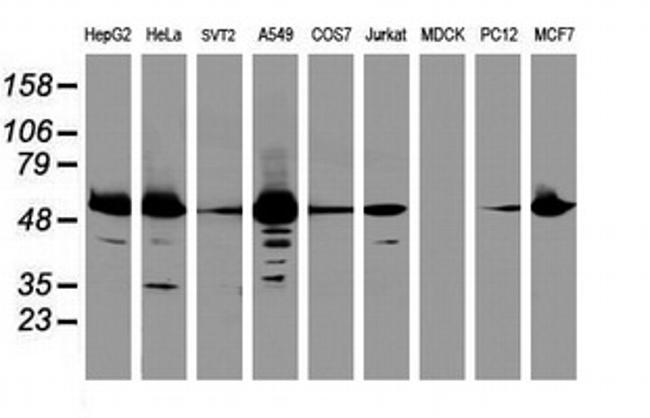 EPHX1 Antibody in Western Blot (WB)