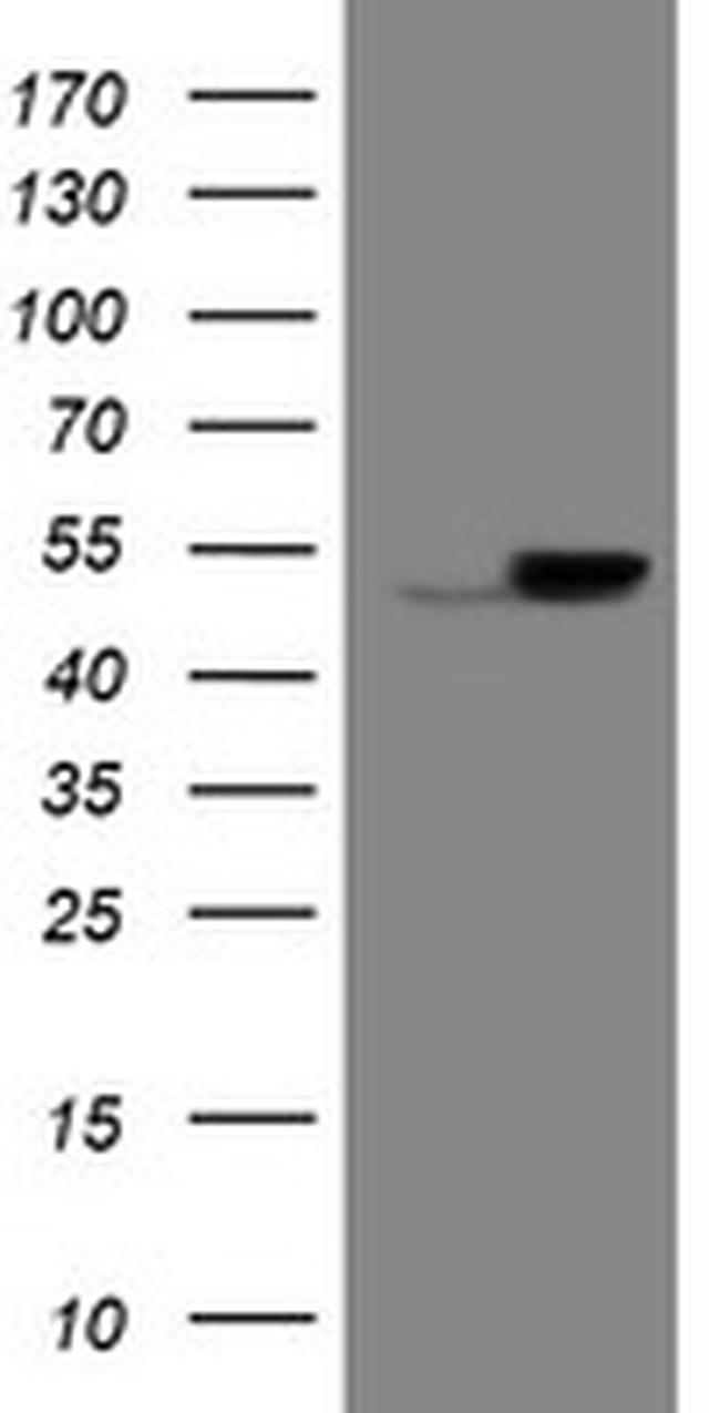 EPHX1 Antibody in Western Blot (WB)