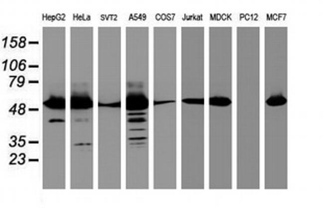 EPHX1 Antibody in Western Blot (WB)