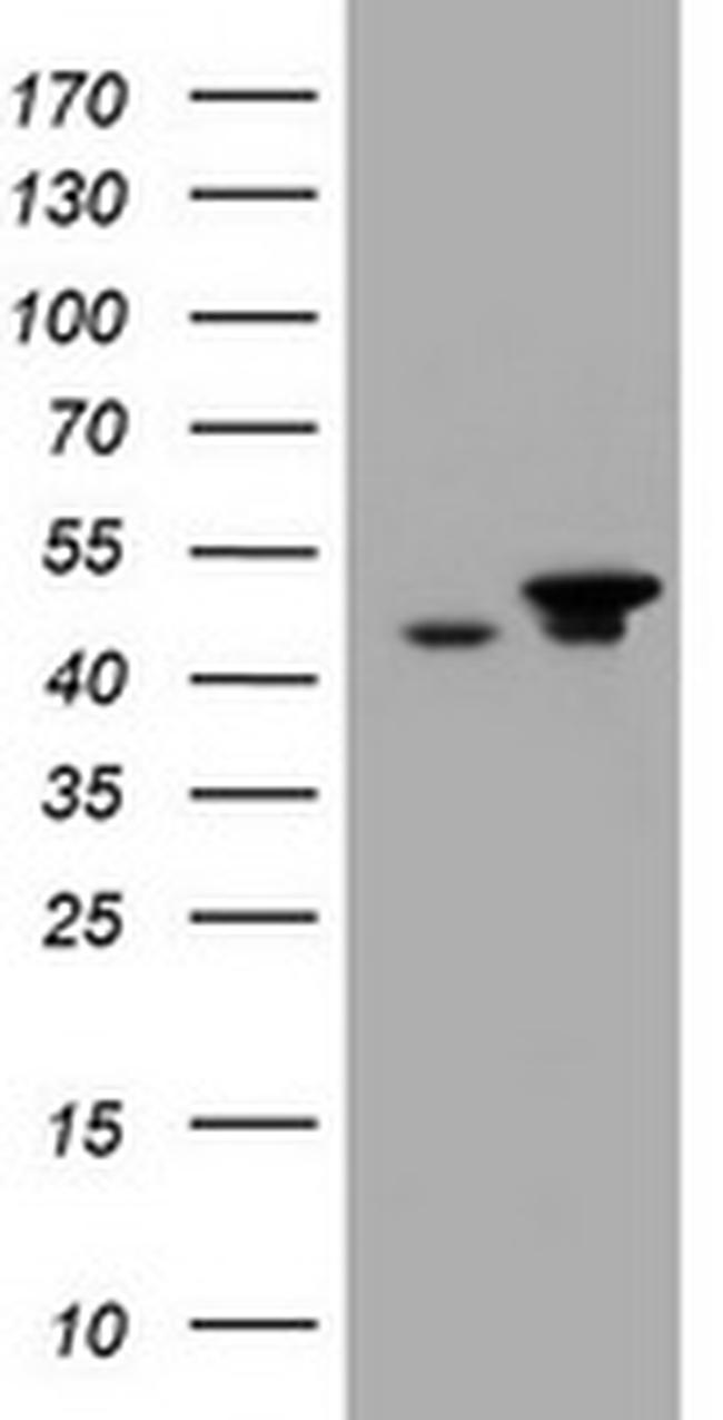 EPHX1 Antibody in Western Blot (WB)