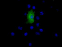 EPHX2 Antibody in Immunocytochemistry (ICC/IF)