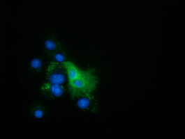 EPHX2 Antibody in Immunocytochemistry (ICC/IF)