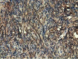 EPHX2 Antibody in Immunohistochemistry (Paraffin) (IHC (P))