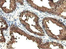 EPHX2 Antibody in Immunohistochemistry (Paraffin) (IHC (P))