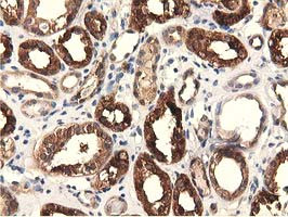 EPHX2 Antibody in Immunohistochemistry (Paraffin) (IHC (P))