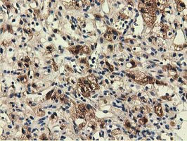 EPHX2 Antibody in Immunohistochemistry (Paraffin) (IHC (P))