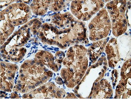 EPHX2 Antibody in Immunohistochemistry (Paraffin) (IHC (P))