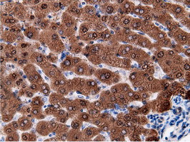 EPHX2 Antibody in Immunohistochemistry (Paraffin) (IHC (P))