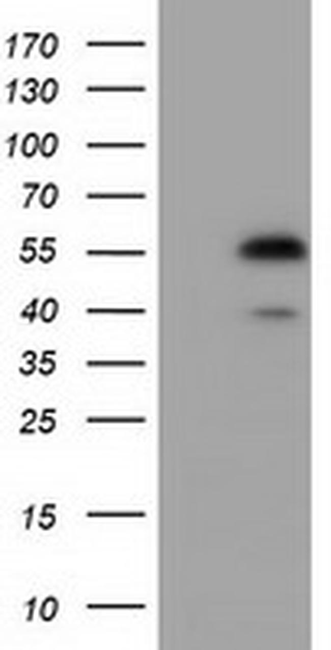 EPHX2 Antibody in Western Blot (WB)